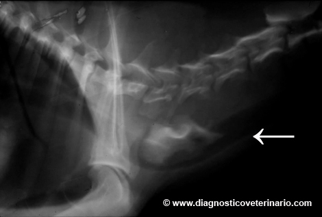 Radiografia hueso esofago cervical