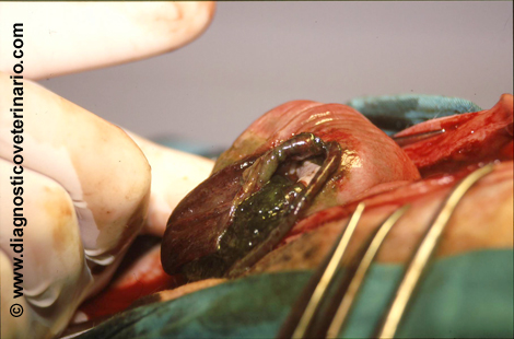 Rotura uterina por distocia