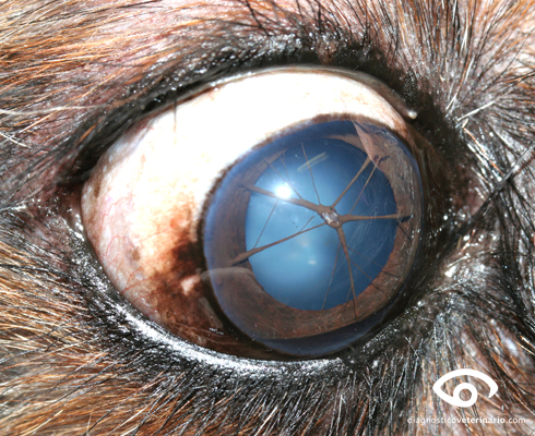 Membrana pupilar persistente