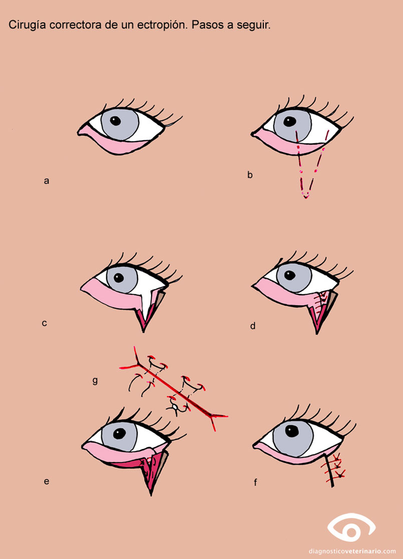 ectropion dibujo cirugia ojo sutura