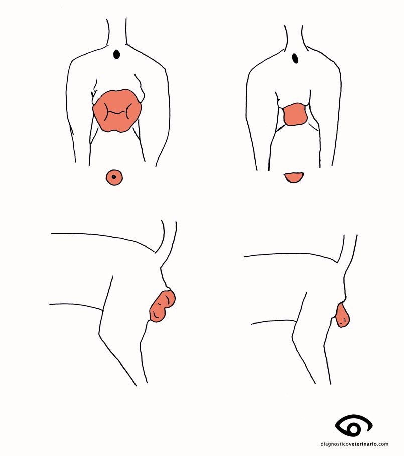 prolapso vaginal vs hiperplasia suelo esquema
