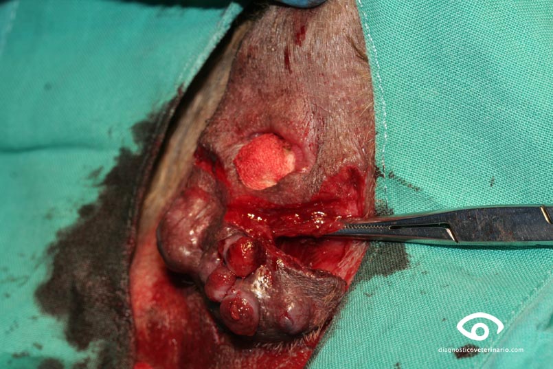 circumanales cirugia hemostasia y corte