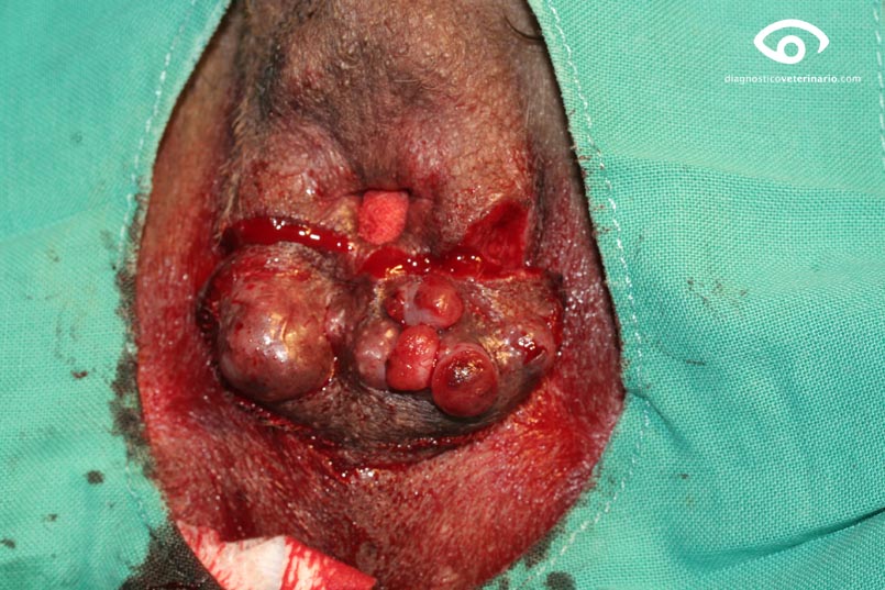 cirugia circumanales primera incisión
