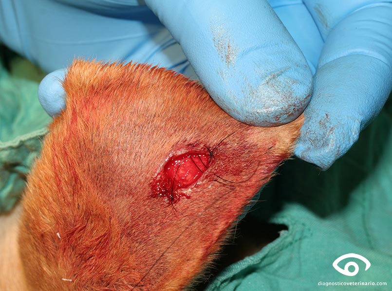 Extracción de neoplasia cutánea mediante bisturí y tijera, sutura, histiocitoma.